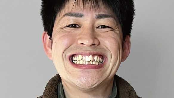 施術前