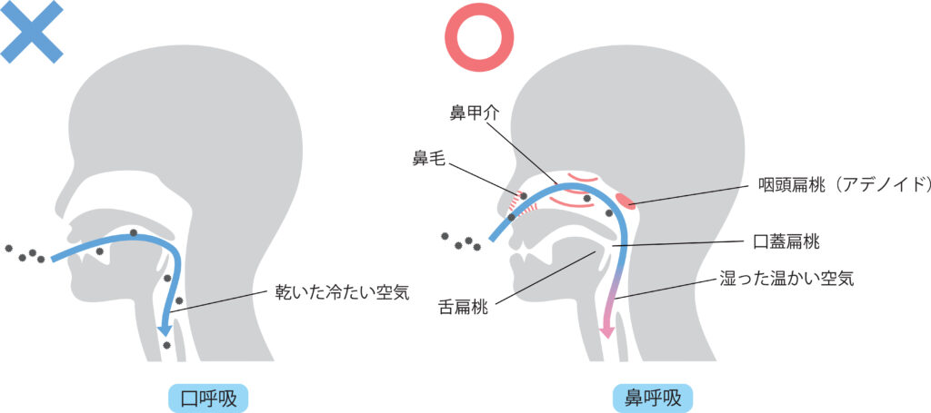 アデノイド顔貌系の記事