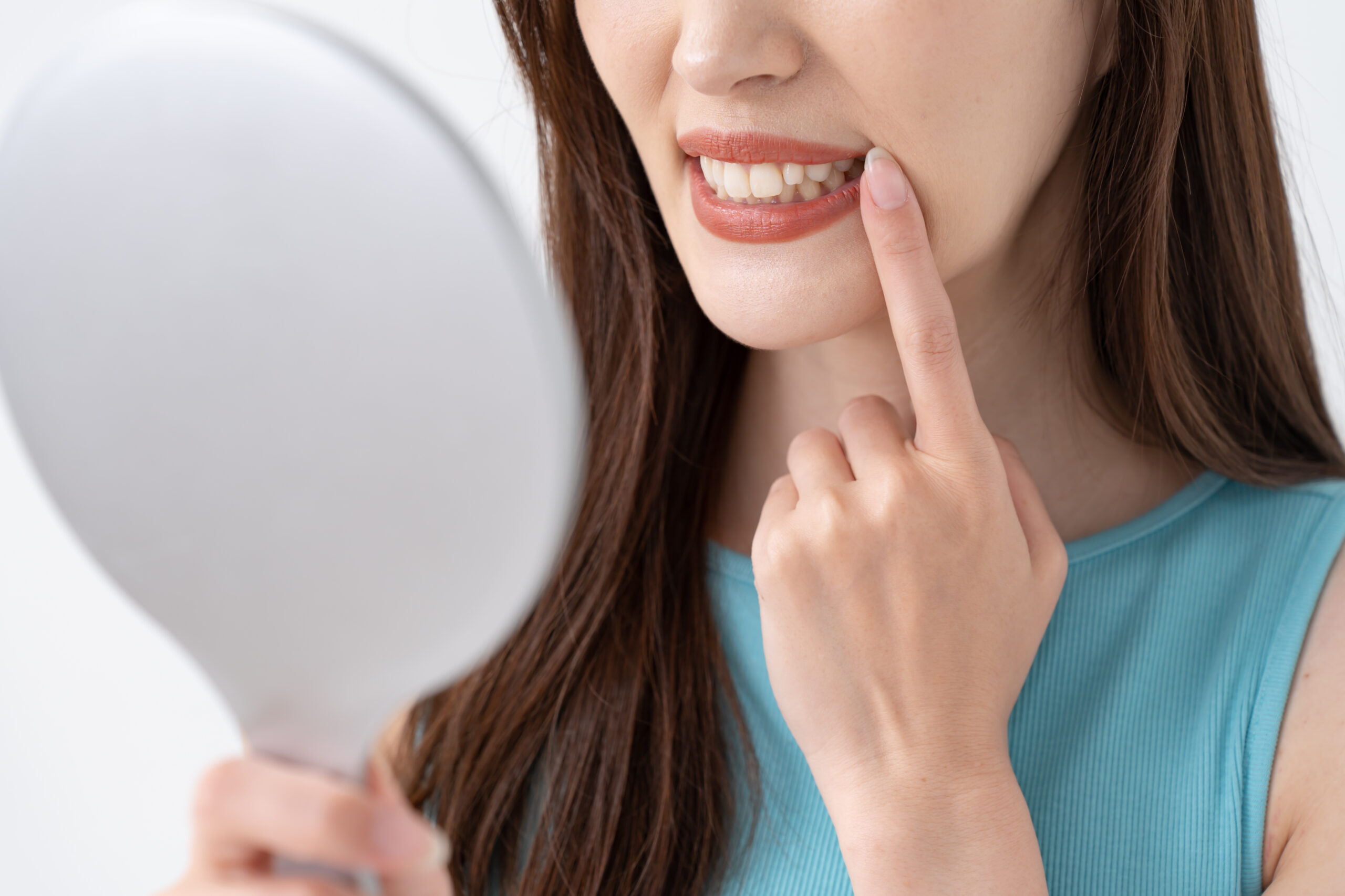 部分矯正 出っ歯