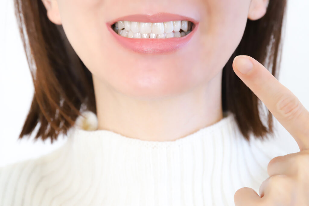 部分矯正 口ゴボ